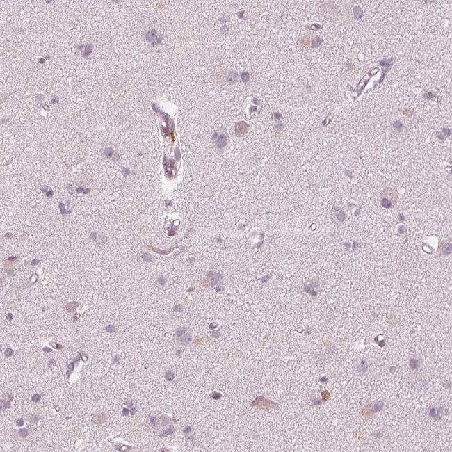 ACACB Antibody in Immunohistochemistry (IHC)