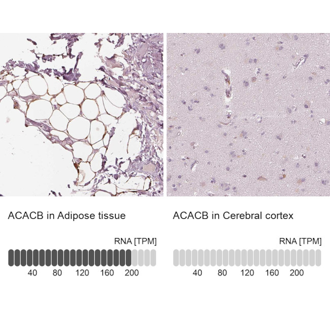 ACACB Antibody