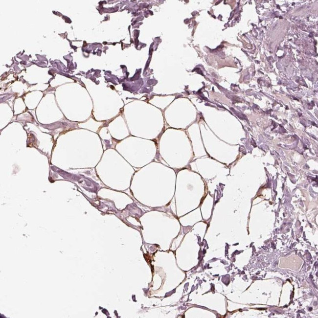 ACACB Antibody in Immunohistochemistry (IHC)