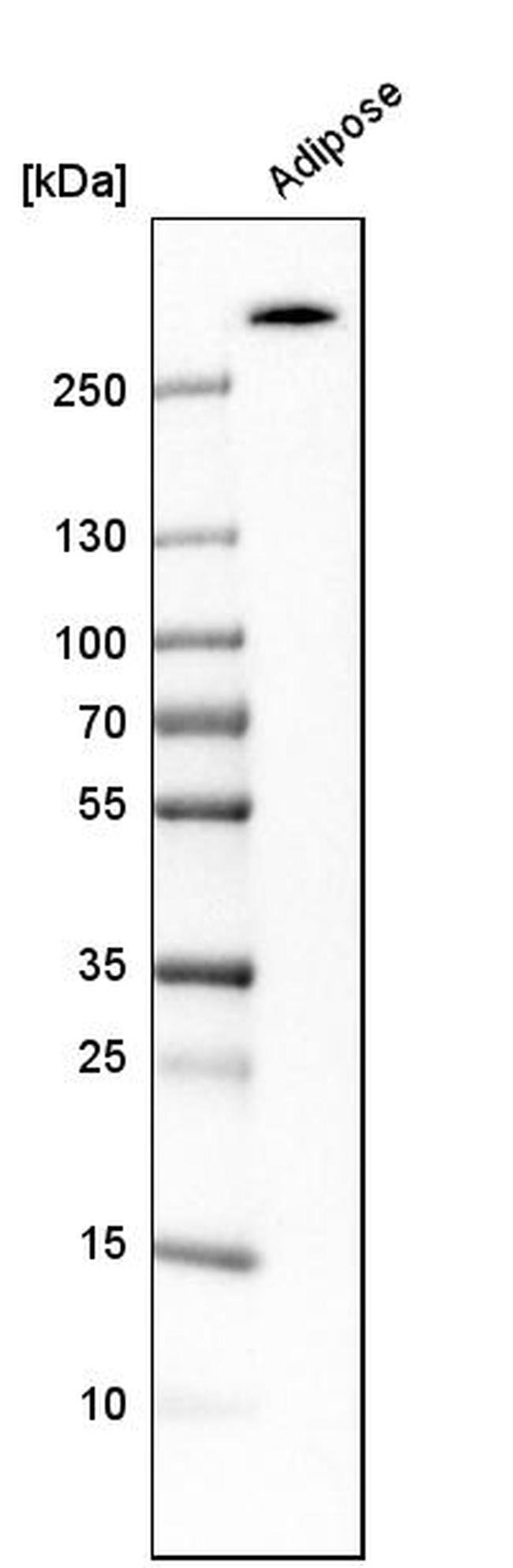 ACACB Antibody in Western Blot (WB)