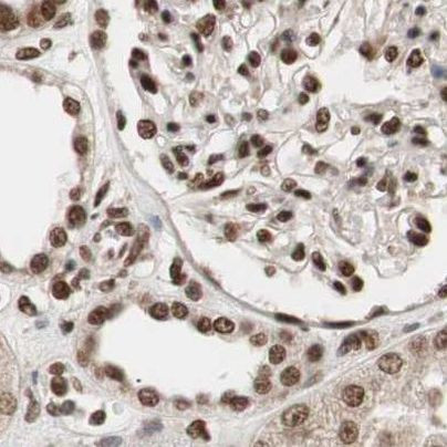 CHAMP1 Antibody in Immunohistochemistry (IHC)