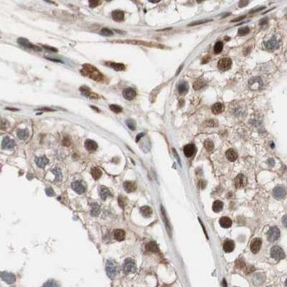 CHAMP1 Antibody in Immunohistochemistry (IHC)