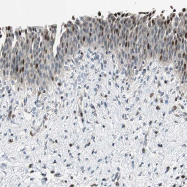 RAD1 Antibody in Immunohistochemistry (IHC)