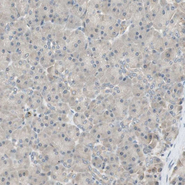 PSMD8 Antibody in Immunohistochemistry (IHC)