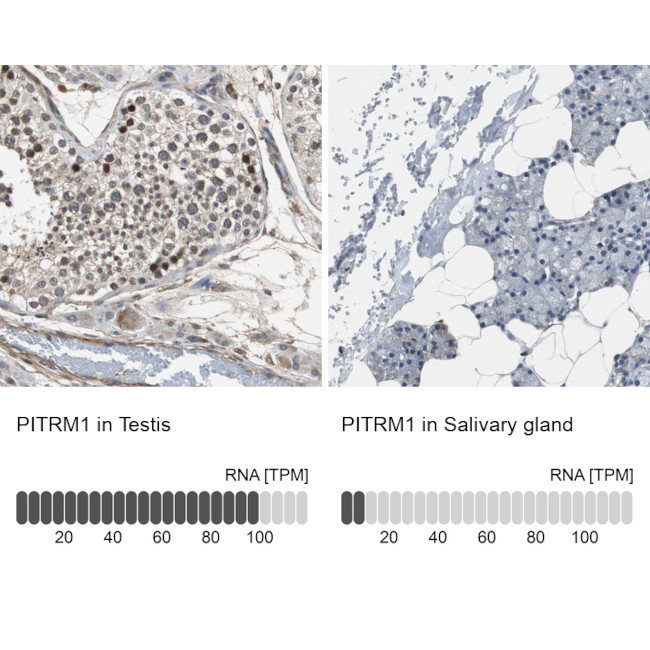 PITRM1 Antibody in Immunohistochemistry (IHC)