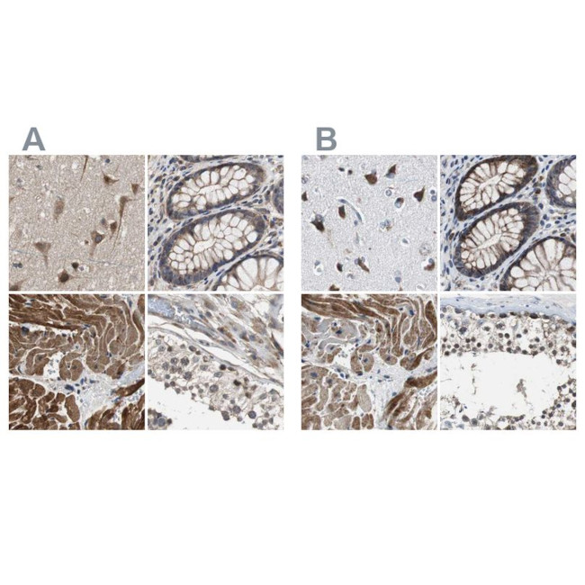 PITRM1 Antibody in Immunohistochemistry (IHC)