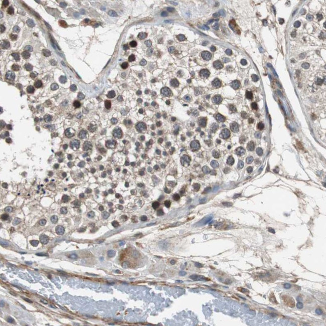 PITRM1 Antibody in Immunohistochemistry (IHC)