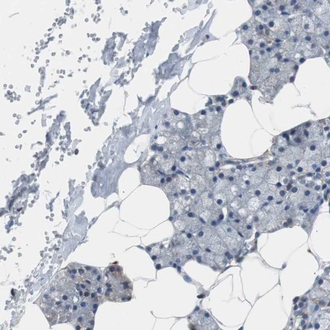 PITRM1 Antibody in Immunohistochemistry (IHC)