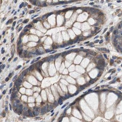 PITRM1 Antibody in Immunohistochemistry (IHC)