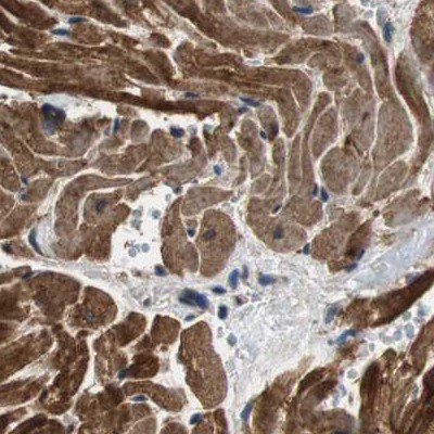 PITRM1 Antibody in Immunohistochemistry (IHC)