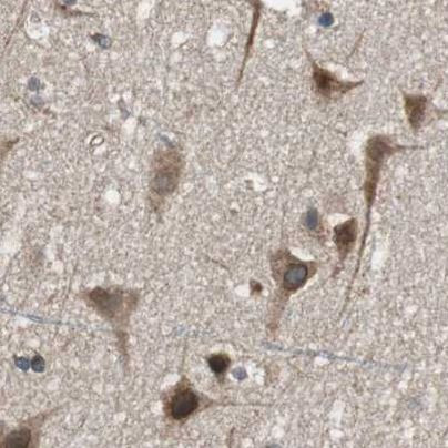 PITRM1 Antibody in Immunohistochemistry (IHC)