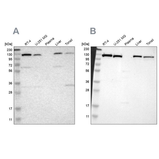 PITRM1 Antibody in Western Blot (WB)