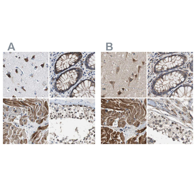 PITRM1 Antibody in Immunohistochemistry (IHC)