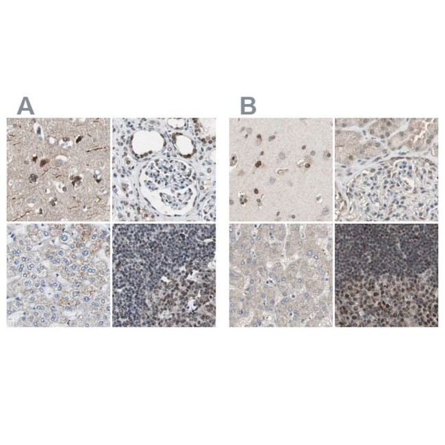 ZHX2 Antibody in Immunohistochemistry (IHC)