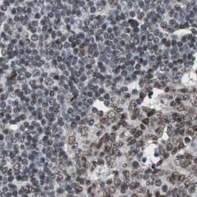 ZHX2 Antibody in Immunohistochemistry (IHC)