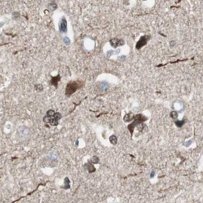 ZHX2 Antibody in Immunohistochemistry (IHC)