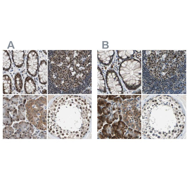 USP28 Antibody in Immunohistochemistry (IHC)