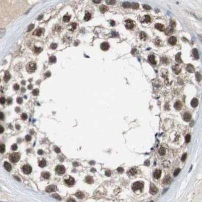 USP28 Antibody in Immunohistochemistry (IHC)