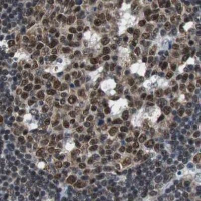 USP28 Antibody in Immunohistochemistry (IHC)