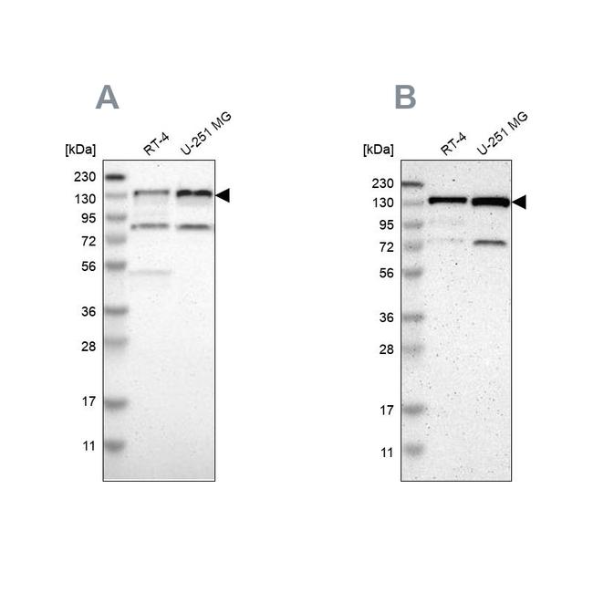 USP28 Antibody in Western Blot (WB)