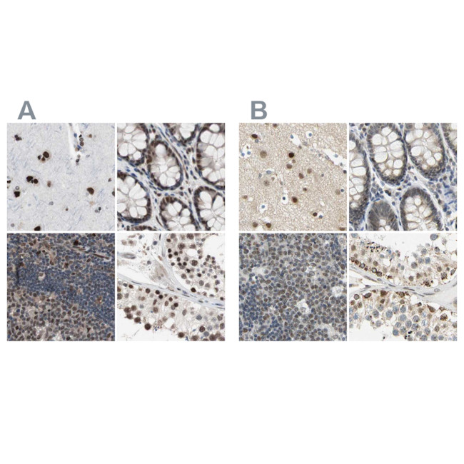 POGZ Antibody in Immunohistochemistry (IHC)