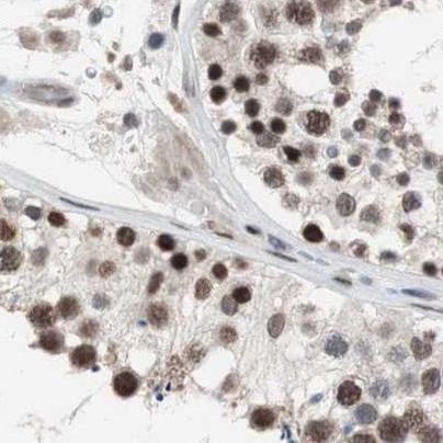 POGZ Antibody in Immunohistochemistry (IHC)