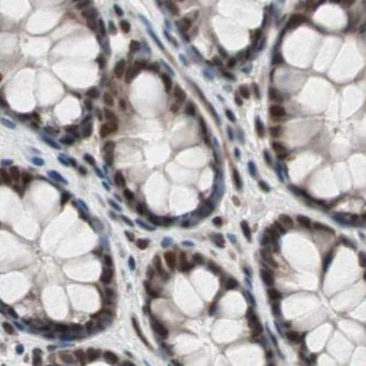 POGZ Antibody in Immunohistochemistry (IHC)