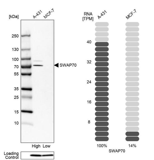 SWAP70 Antibody in Western Blot (WB)