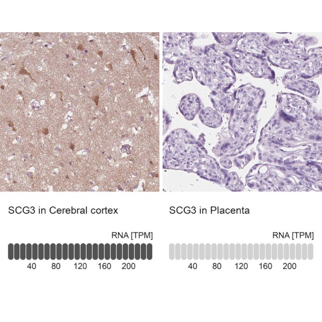 SCG3 Antibody in Immunohistochemistry (IHC)