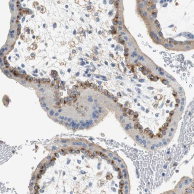 VAMP8 Antibody in Immunohistochemistry (IHC)