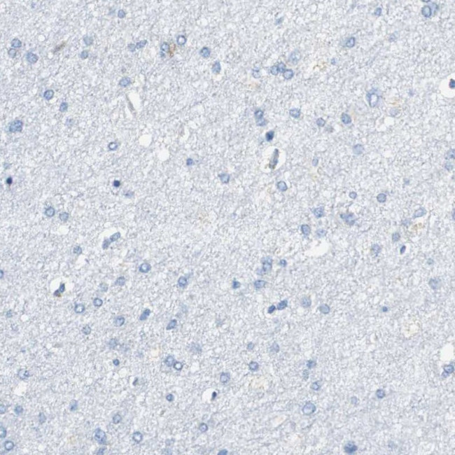 VAMP8 Antibody in Immunohistochemistry (IHC)