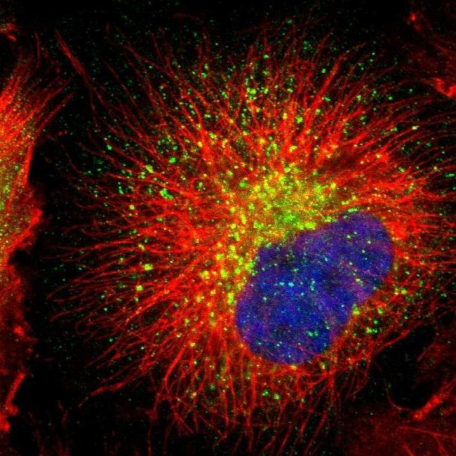 RAB7 Antibody in Immunocytochemistry (ICC/IF)