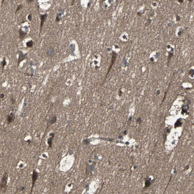 RAB7 Antibody in Immunohistochemistry (IHC)