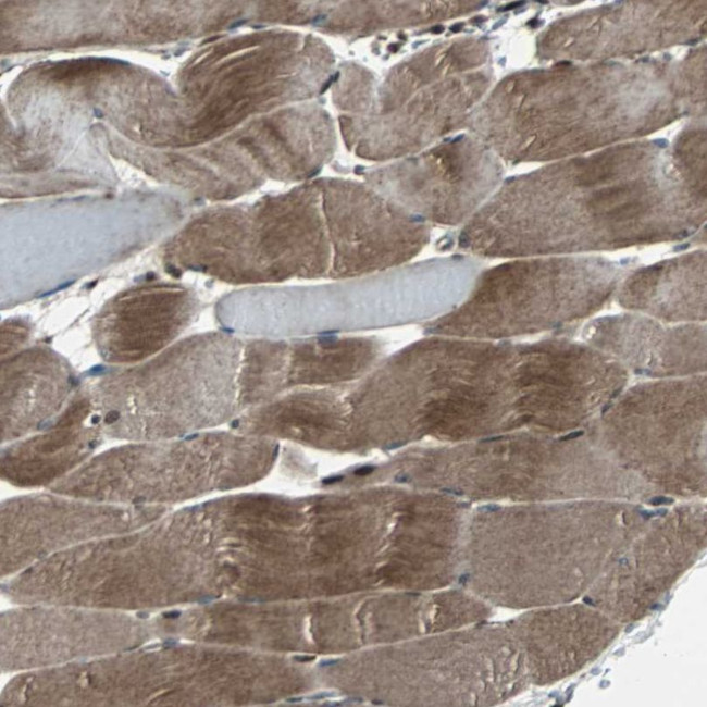 RAB7 Antibody in Immunohistochemistry (IHC)