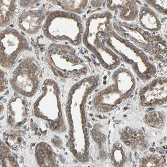 RAB7 Antibody in Immunohistochemistry (IHC)