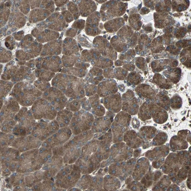 RAB7 Antibody in Immunohistochemistry (IHC)