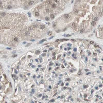 ZHX2 Antibody in Immunohistochemistry (IHC)