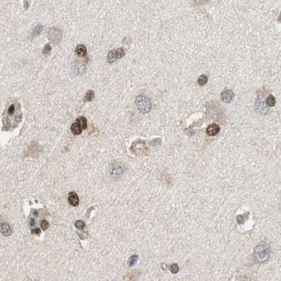 ZHX2 Antibody in Immunohistochemistry (IHC)