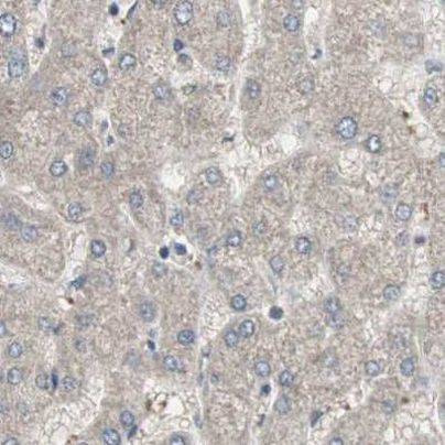 ZHX2 Antibody in Immunohistochemistry (IHC)