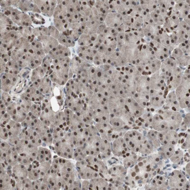 ZHX2 Antibody in Immunohistochemistry (IHC)