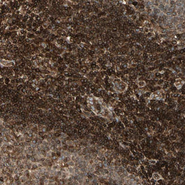 Tapasin Antibody in Immunohistochemistry (IHC)