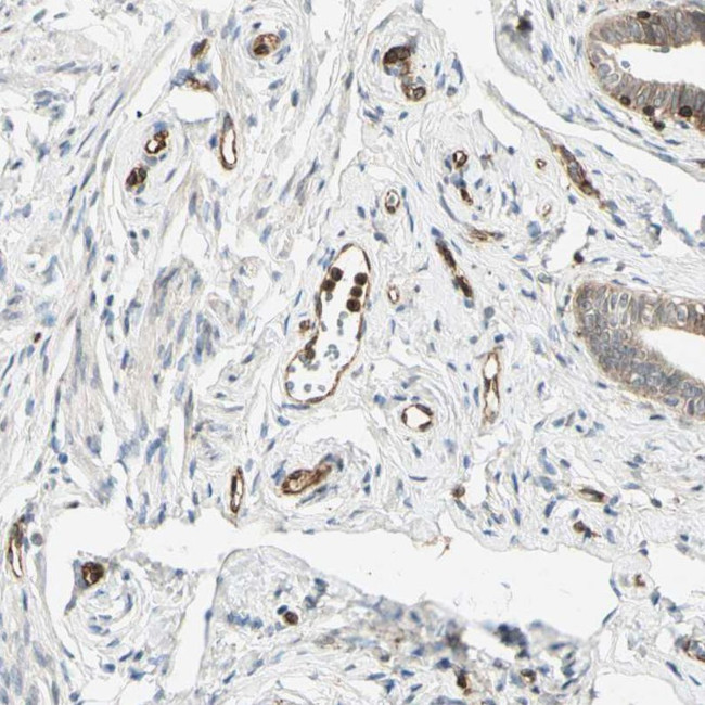 Tapasin Antibody in Immunohistochemistry (IHC)