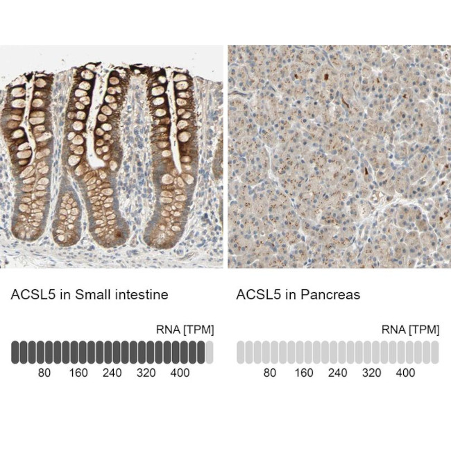 ACSL5 Antibody in Immunohistochemistry (IHC)