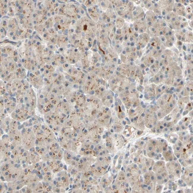 ACSL5 Antibody in Immunohistochemistry (IHC)