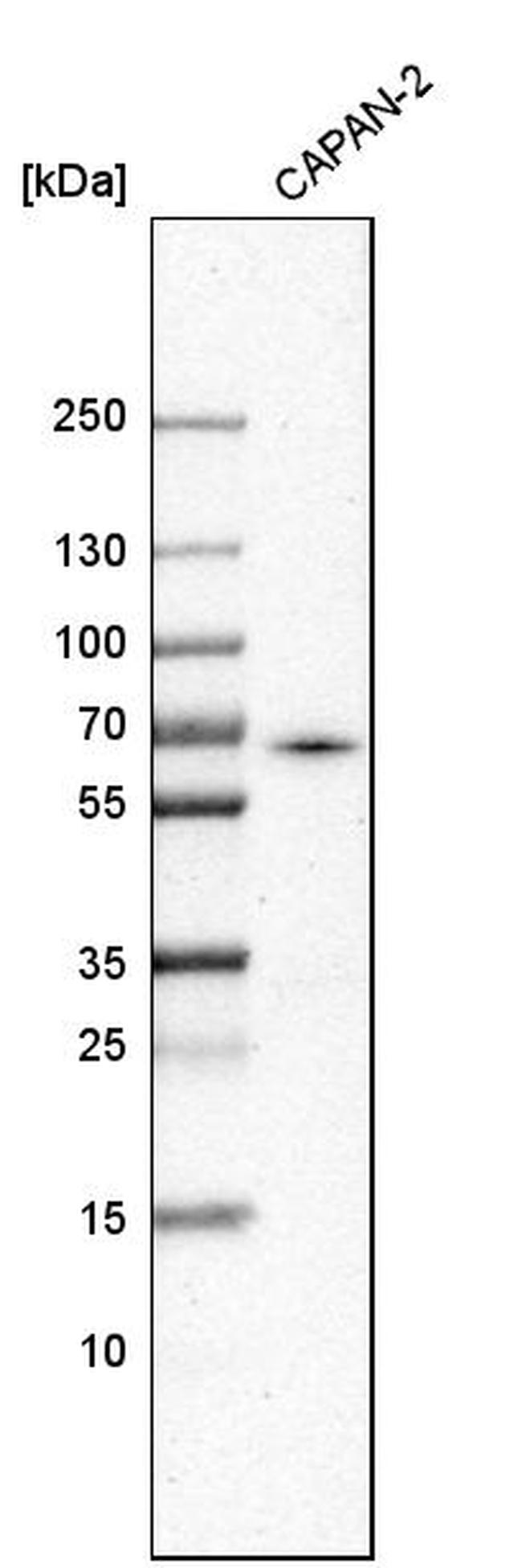 ACSL5 Antibody in Western Blot (WB)