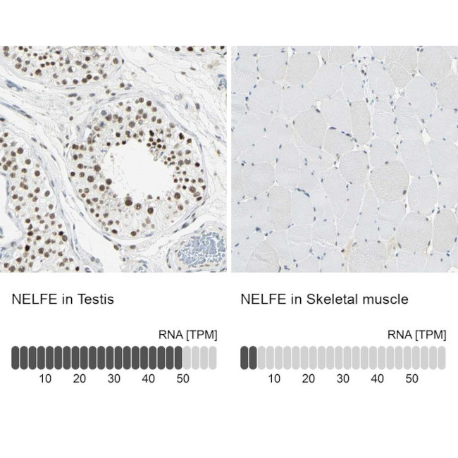 RDBP Antibody in Immunohistochemistry (IHC)