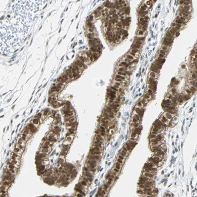 RDBP Antibody in Immunohistochemistry (IHC)