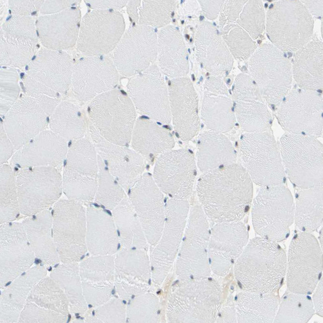 RDBP Antibody in Immunohistochemistry (IHC)