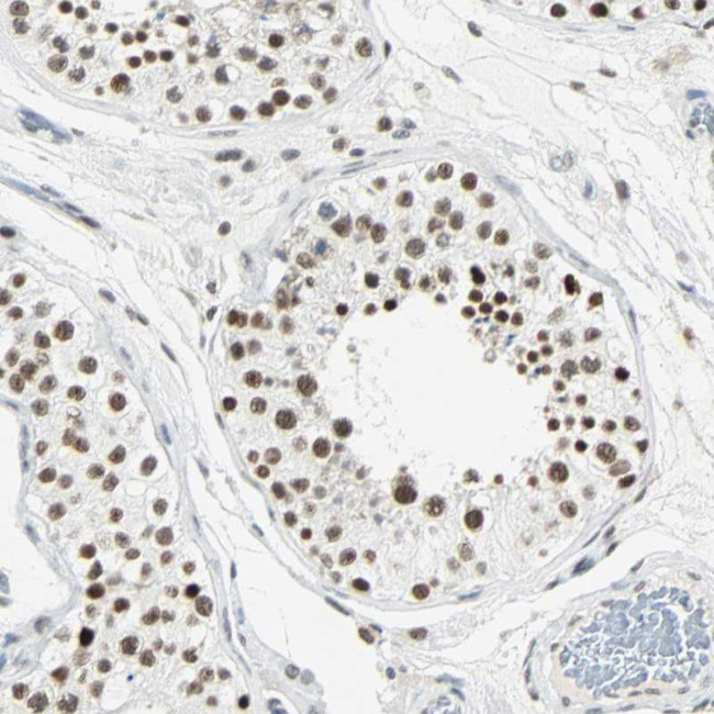 RDBP Antibody in Immunohistochemistry (IHC)