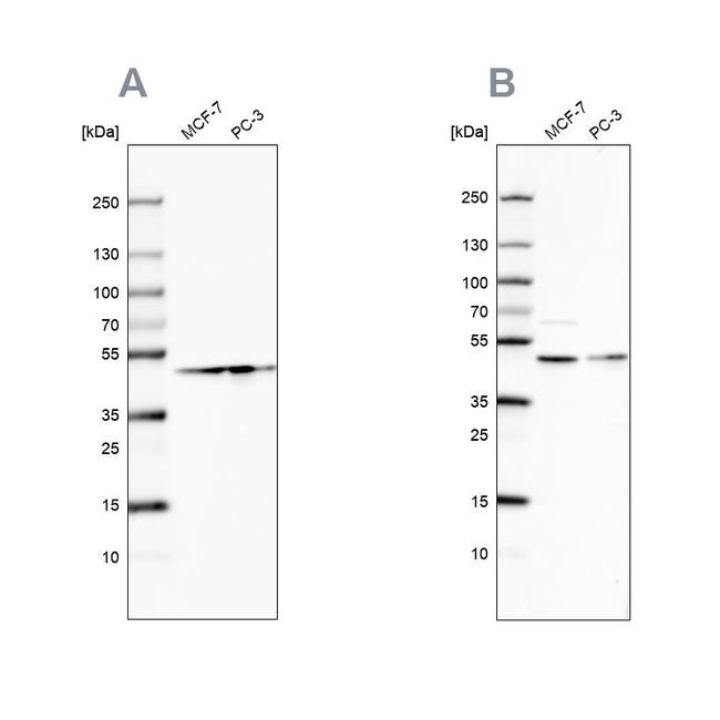 RDBP Antibody in Western Blot (WB)